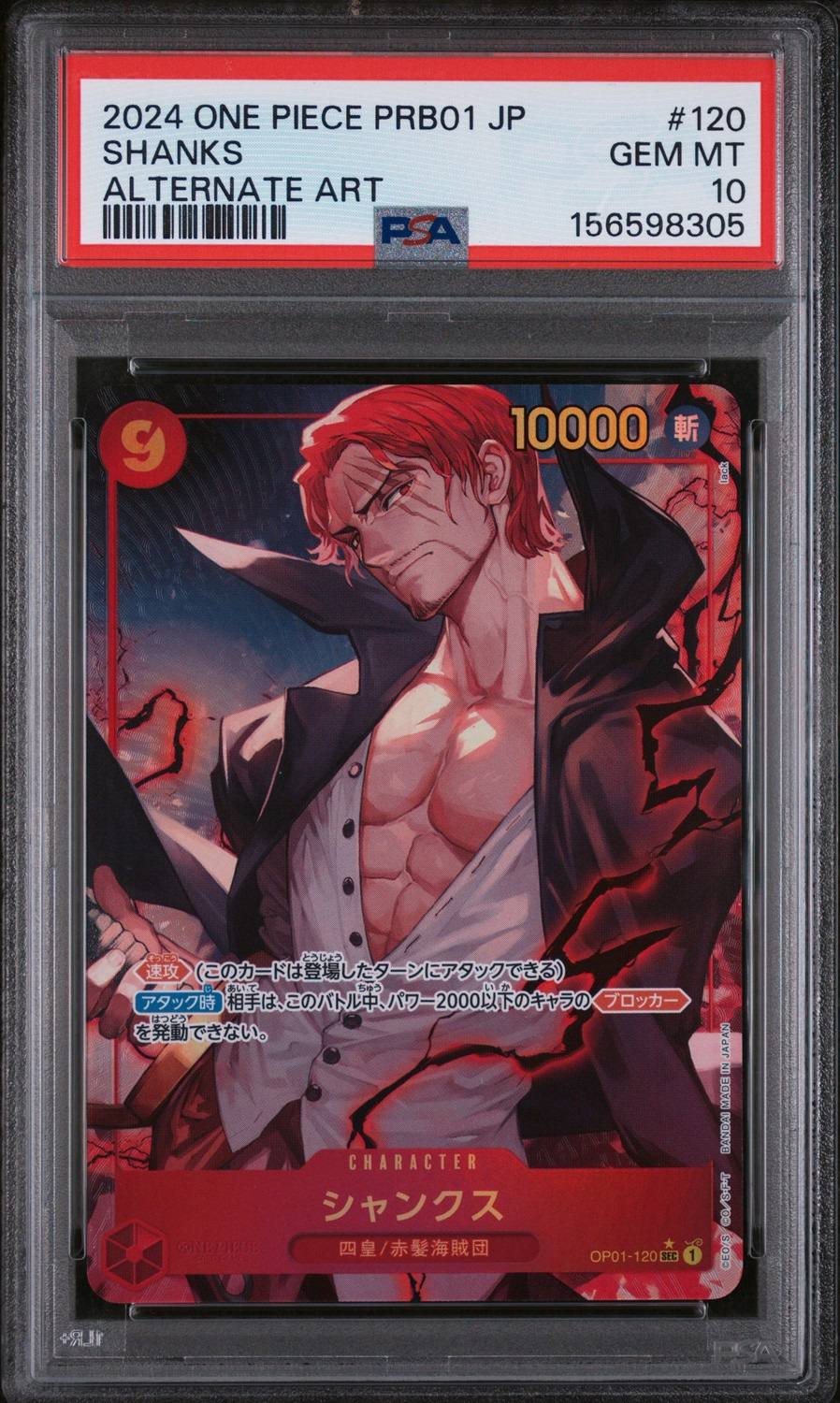 Shanks