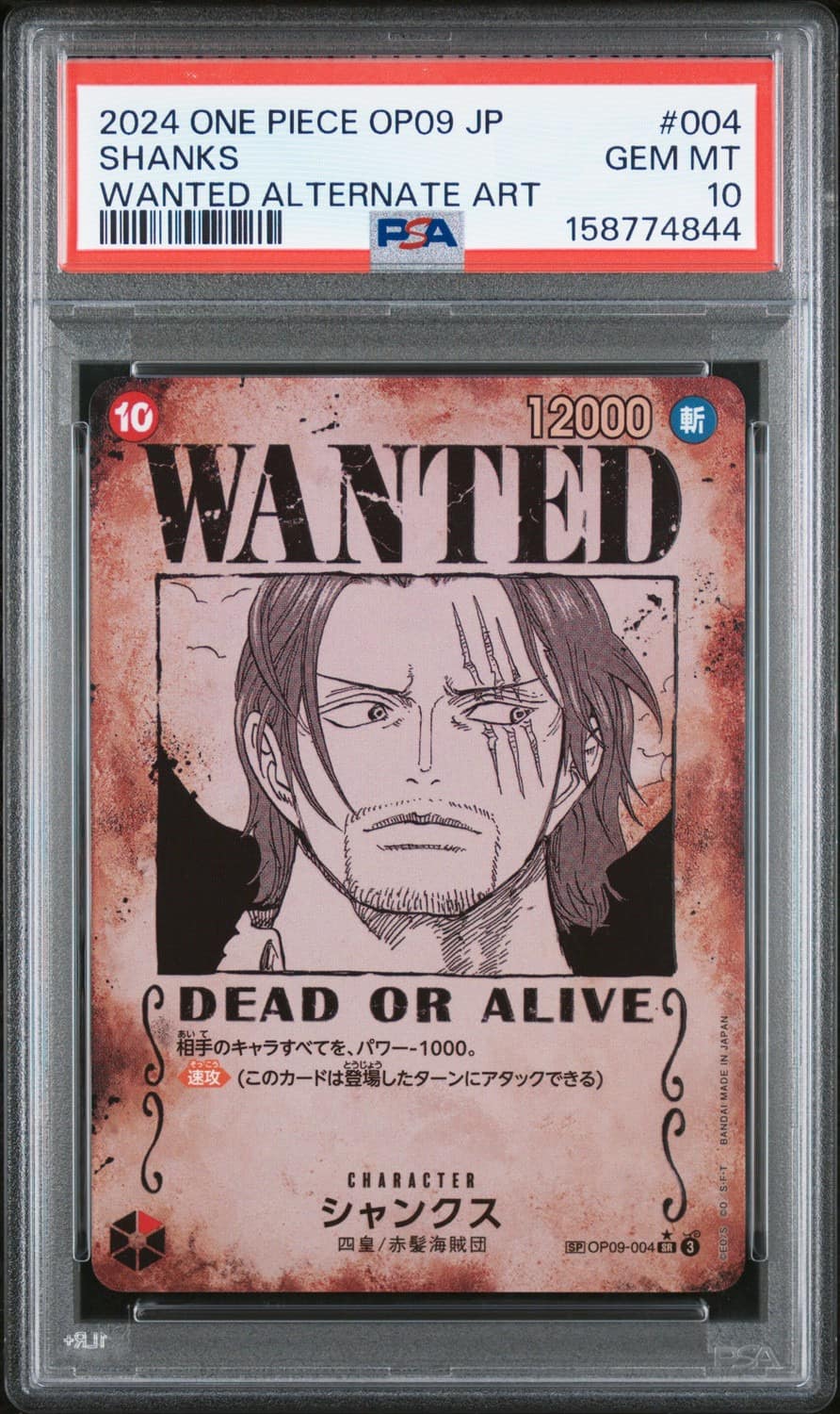 Shanks