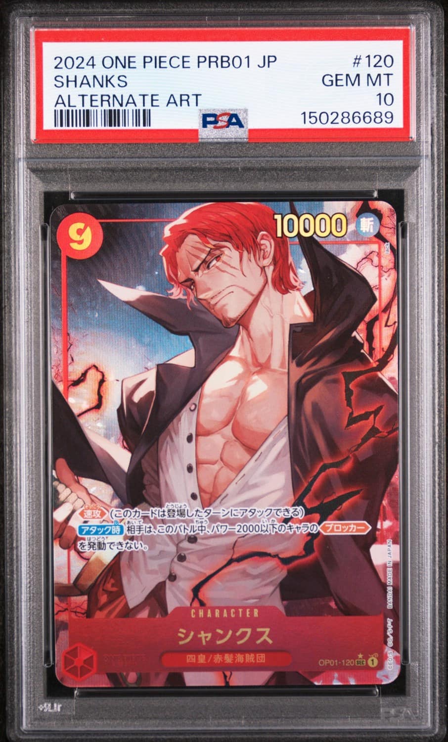 Shanks