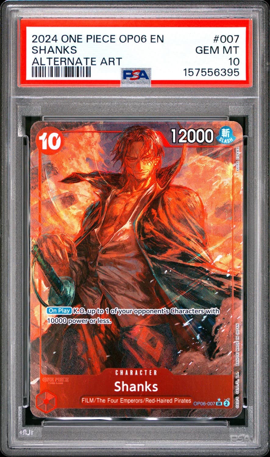 Shanks
