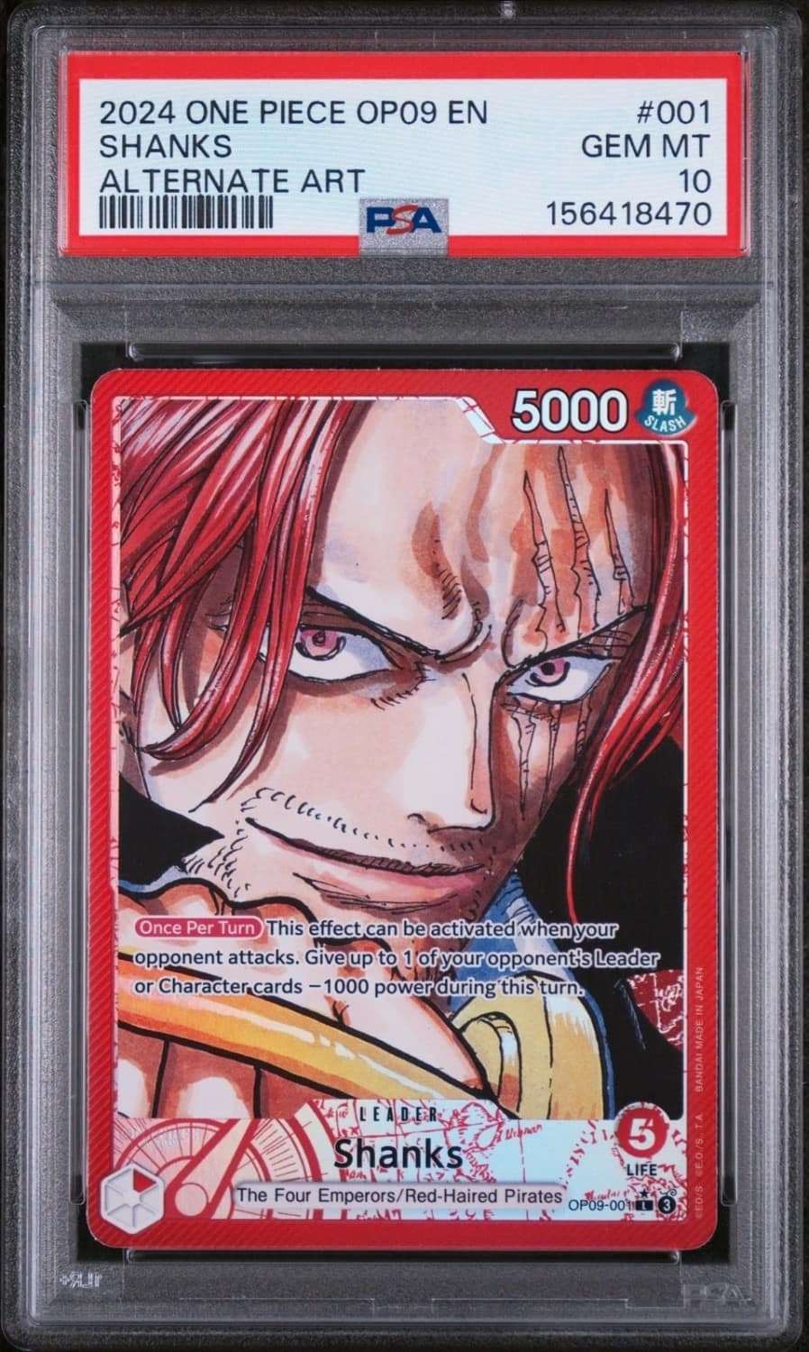 Shanks