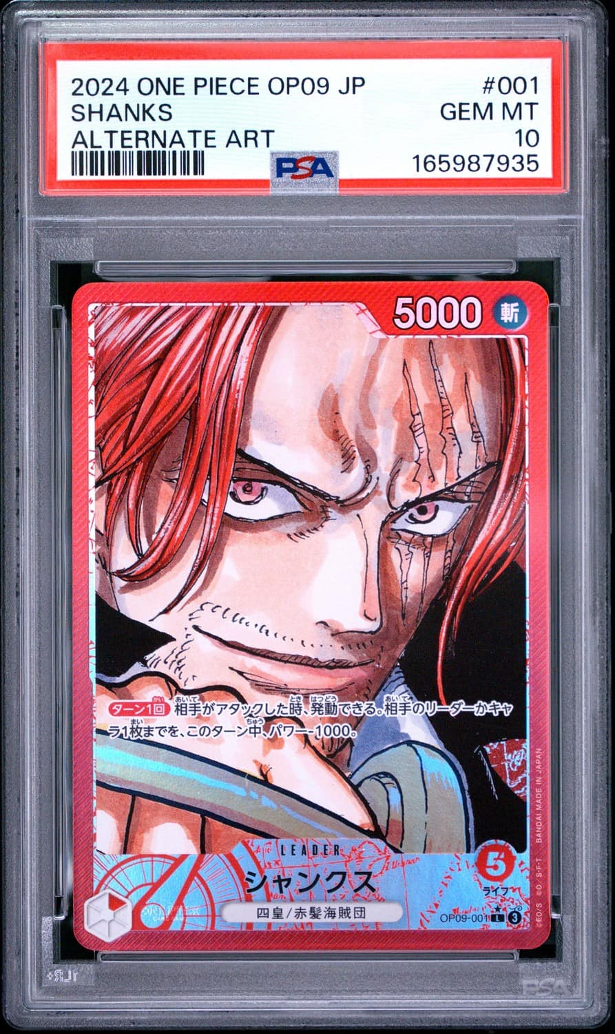 Shanks