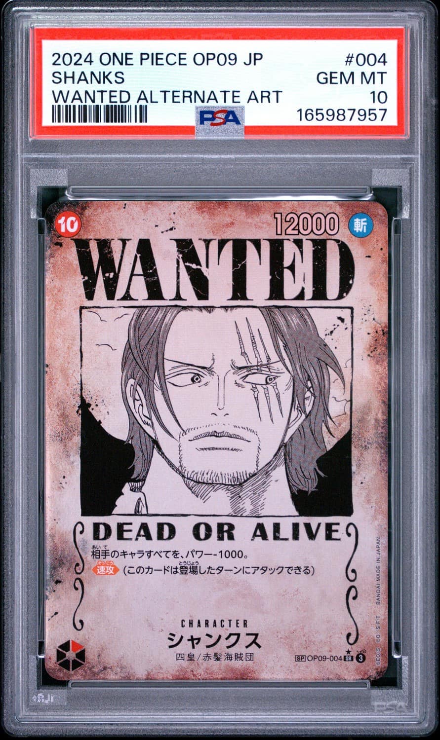 Shanks