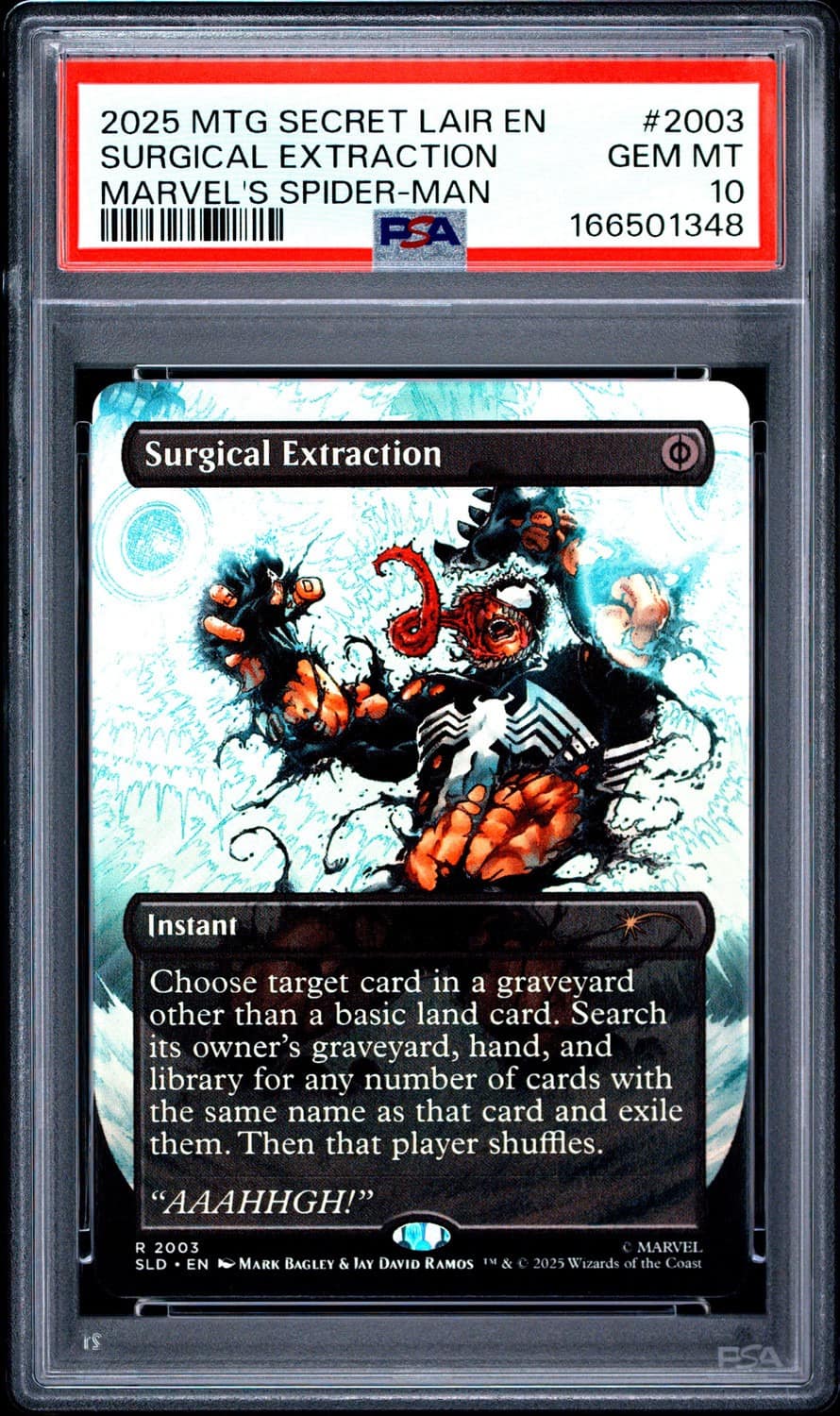 Surgical Extraction