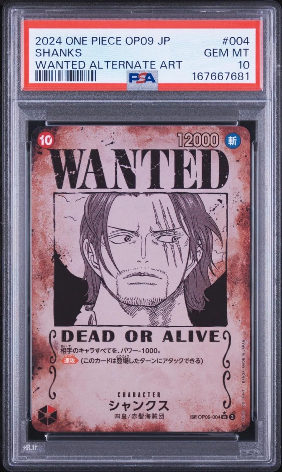 Shanks