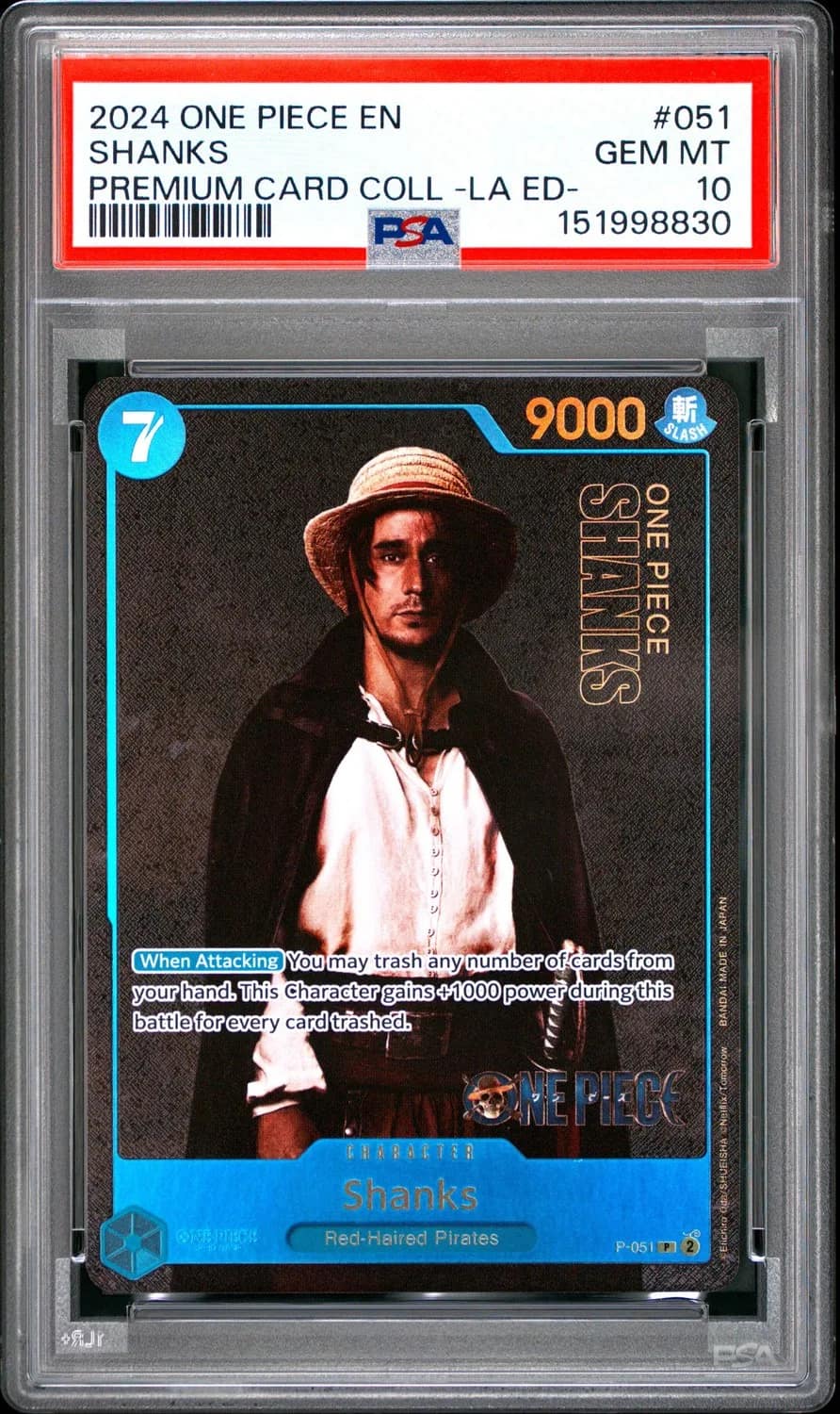 Shanks