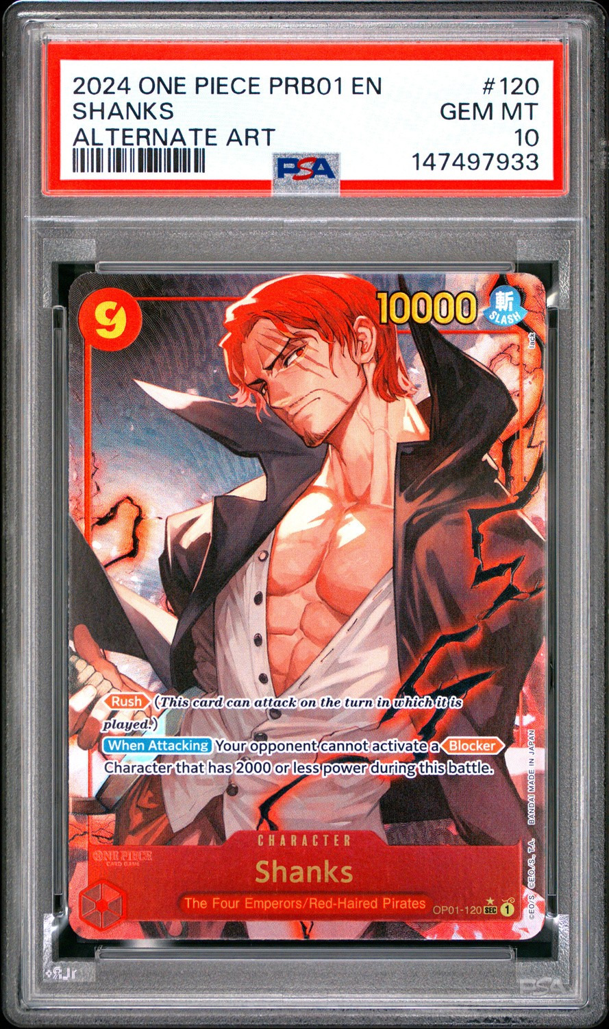 Shanks