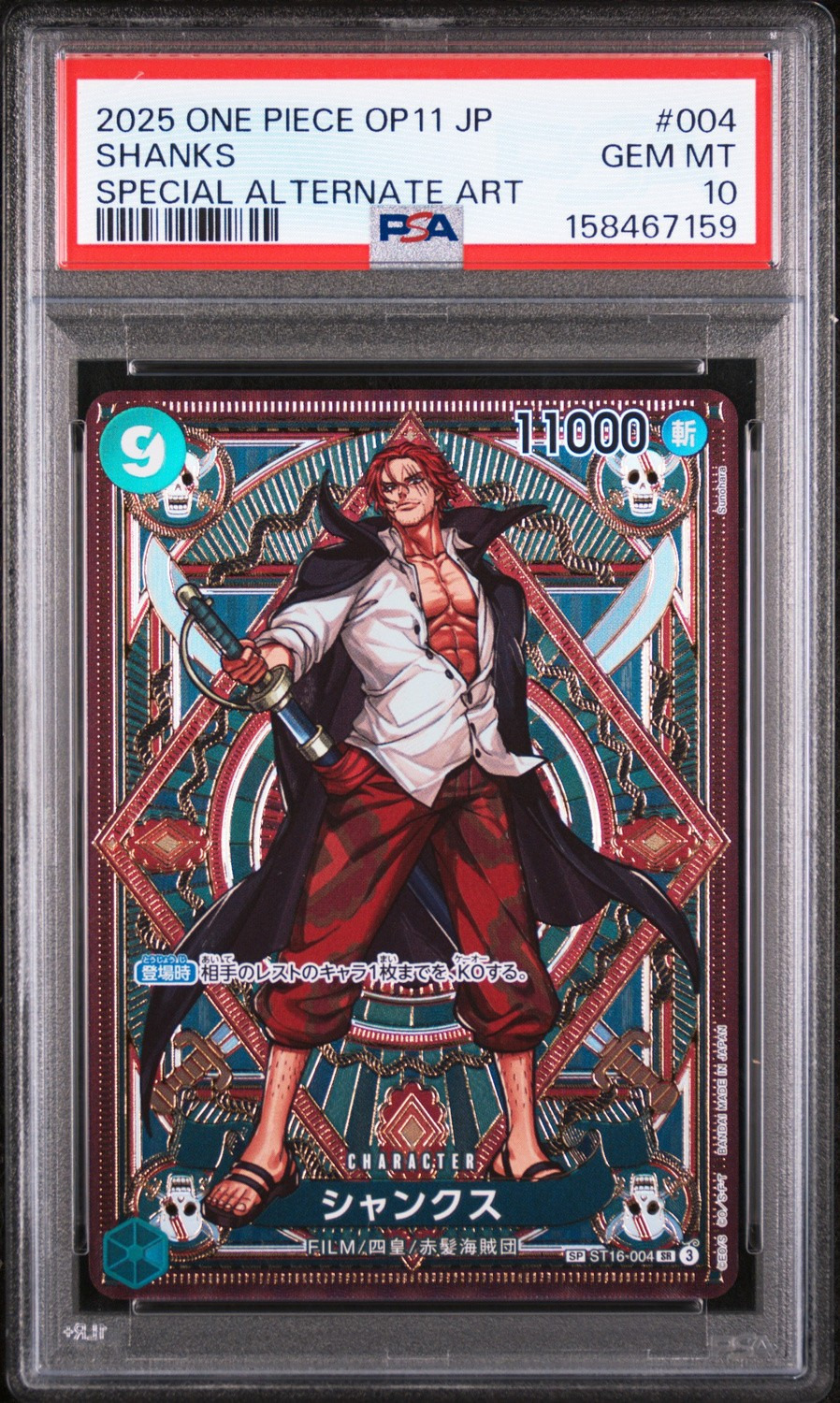 Shanks