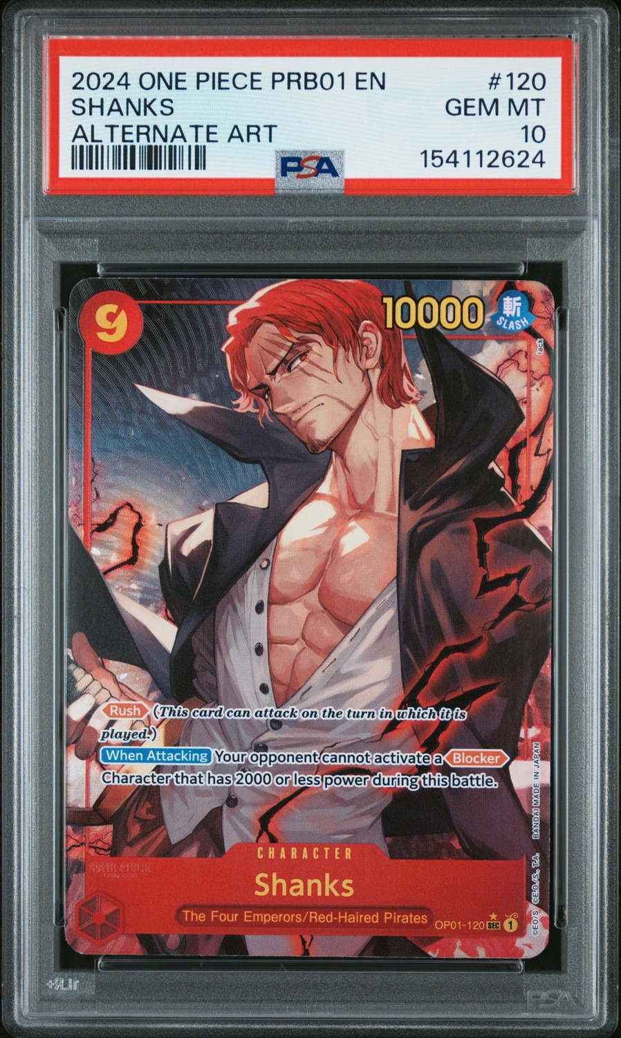 Shanks